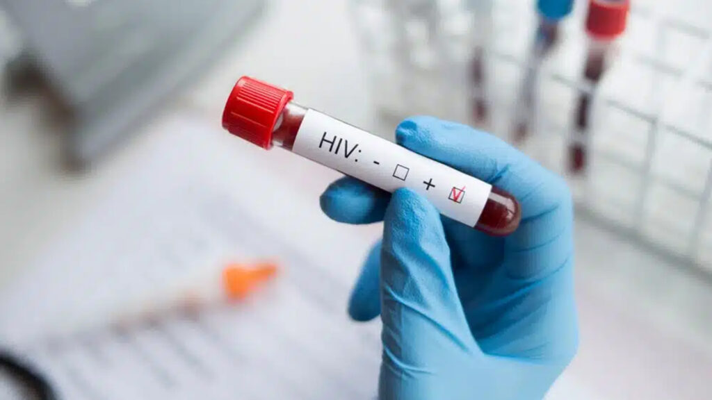 Hiv 2 kopya